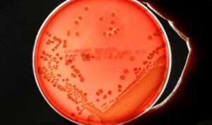 Bakteri-ancam-ekonomi-global-750x600